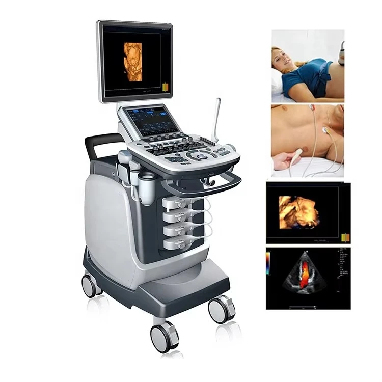 Portable Color Doppler Ultrasound Machine FTL-S7